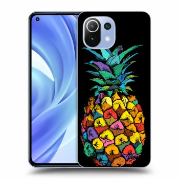 Picasee ULTIMATE CASE Xiaomi Mi 11 Lite - készülékre - Pineapple
