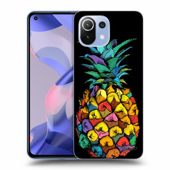 Picasee ULTIMATE CASE Xiaomi 11 Lite 5G NE - készülékre - Pineapple