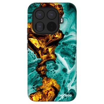 Picasee Fashion Case Xiaomi 15T Pro - Goldsky