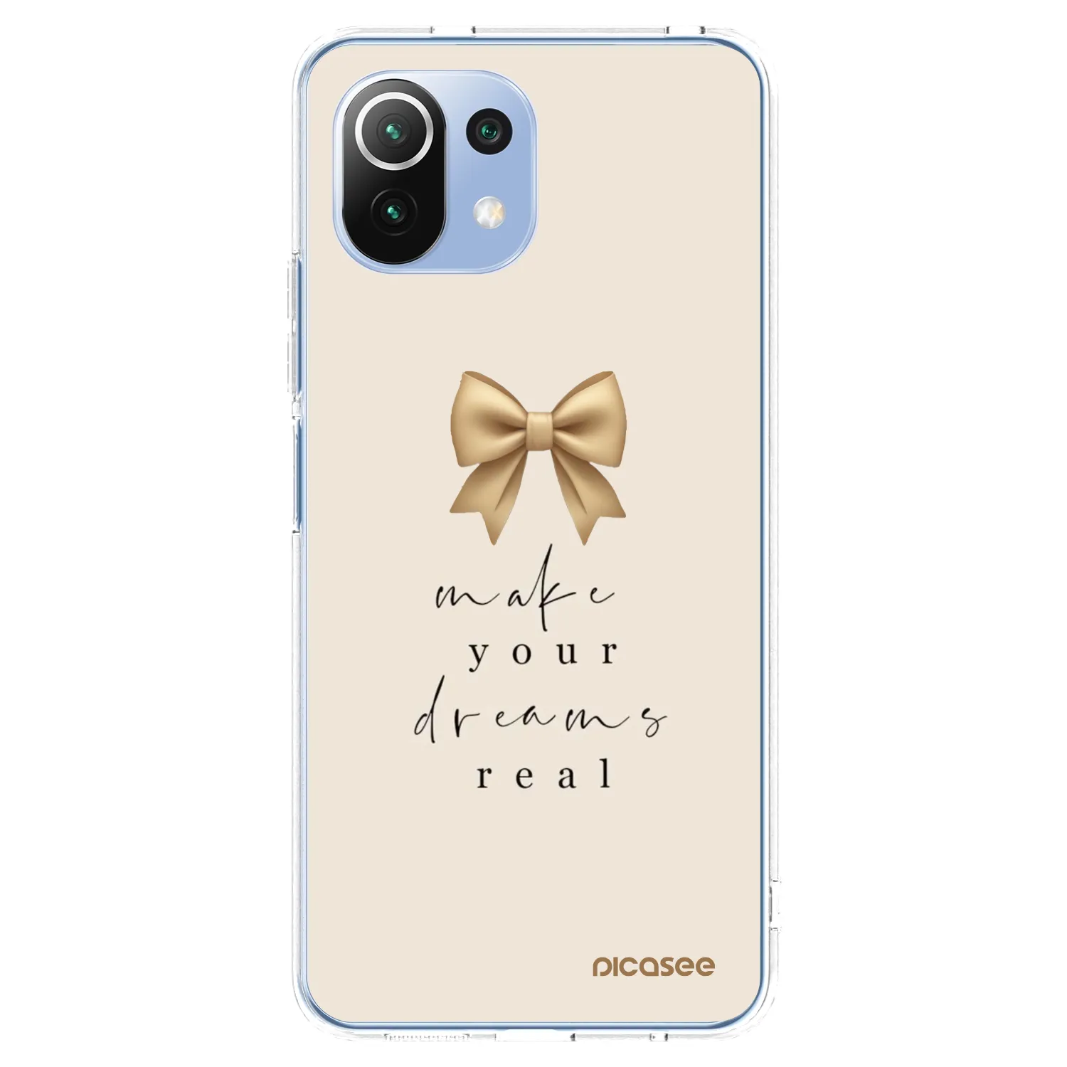 Picasee átlátszó szilikon tok az alábbi mobiltelefonokra Xiaomi Mi 11 Lite - Golden Dream