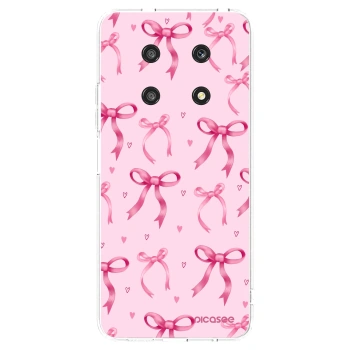 Picasee átlátszó szilikon tok az alábbi mobiltelefonokra Honor Magic4 Lite 5G - Bow Aesthetic