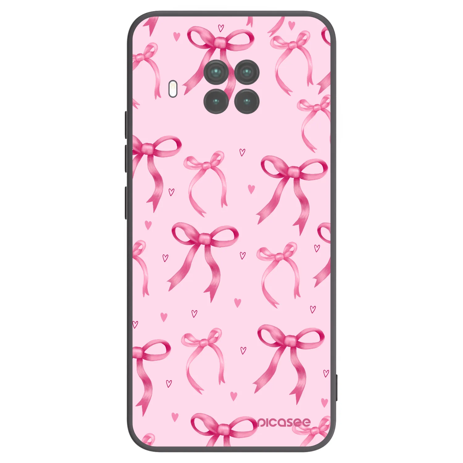 Picasee fekete szilikon tok az alábbi mobiltelefonokra Xiaomi Mi 10T Lite - Bow Aesthetic