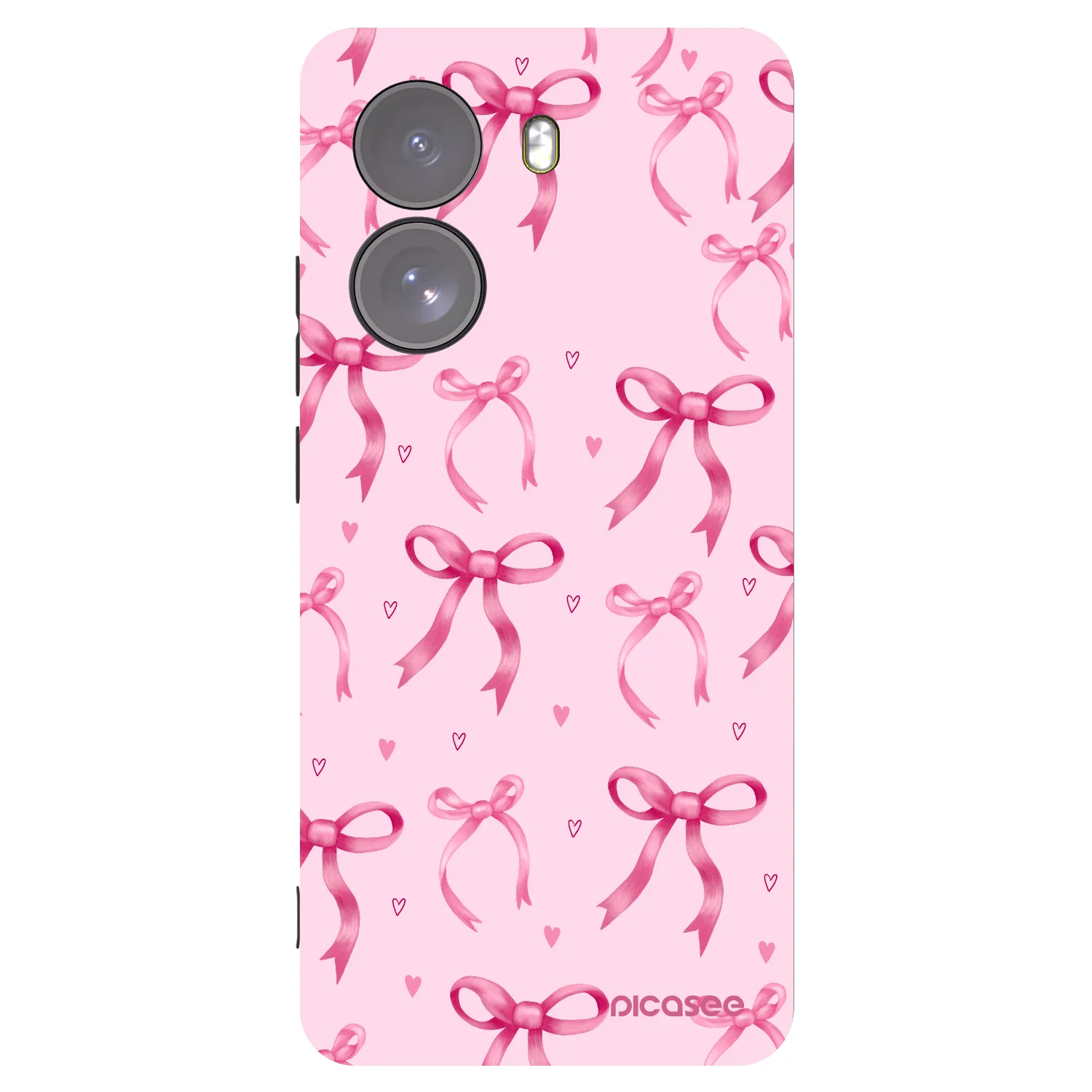 Picasee fekete szilikon tok az alábbi mobiltelefonokra Xiaomi Poco X7 - Bow Aesthetic