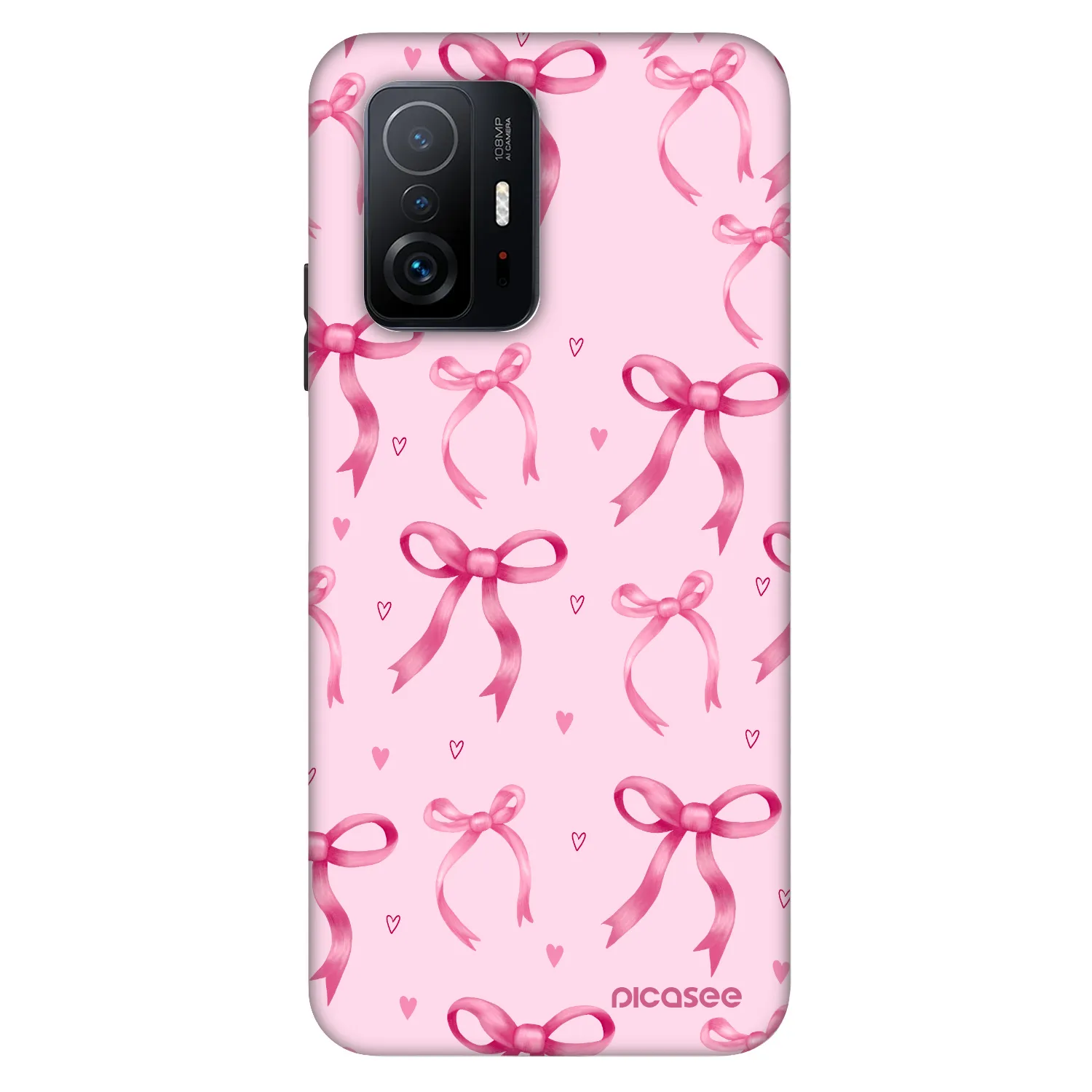 Picasee Fashion Case Xiaomi 11T - Bow Aesthetic
