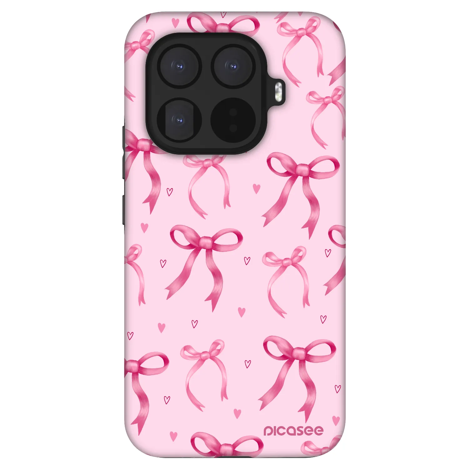 Picasee Fashion Case Xiaomi 15T Pro - Bow Aesthetic