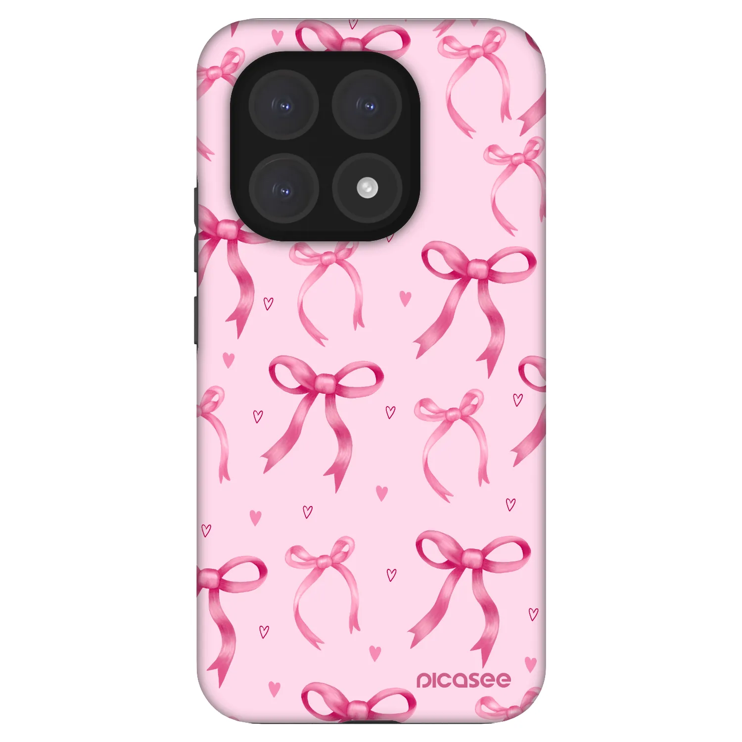 Picasee Fashion Case Xiaomi 15T - Bow Aesthetic