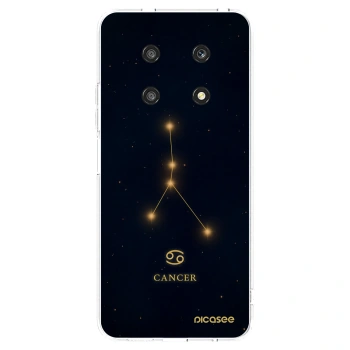 Picasee átlátszó szilikon tok az alábbi mobiltelefonokra Honor Magic4 Lite 5G - CANCER