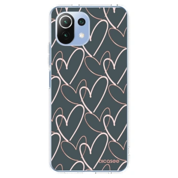 Picasee átlátszó szilikon tok az alábbi mobiltelefonokra Xiaomi 11 Lite 5G NE - Lots of love