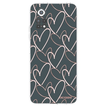 Picasee átlátszó szilikon tok az alábbi mobiltelefonokra Xiaomi Poco X4 Pro 5G - Lots of love