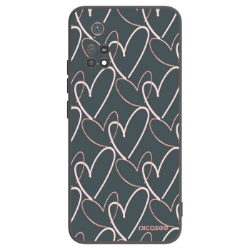 Picasee fekete szilikon tok az alábbi mobiltelefonokra Xiaomi Poco M4 Pro - Lots of love