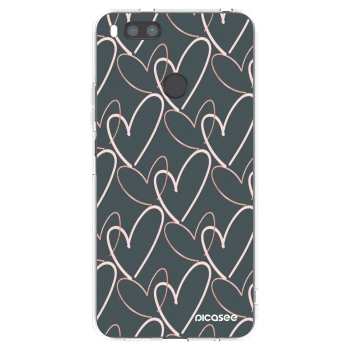 Tok az alábbi mobiltelefonokra Xiaomi Mi A1 Global - Lots of love