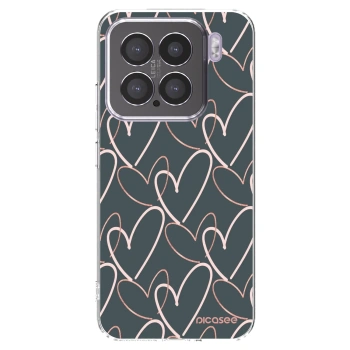 Picasee átlátszó szilikon tok az alábbi mobiltelefonokra Xiaomi 15 - Lots of love