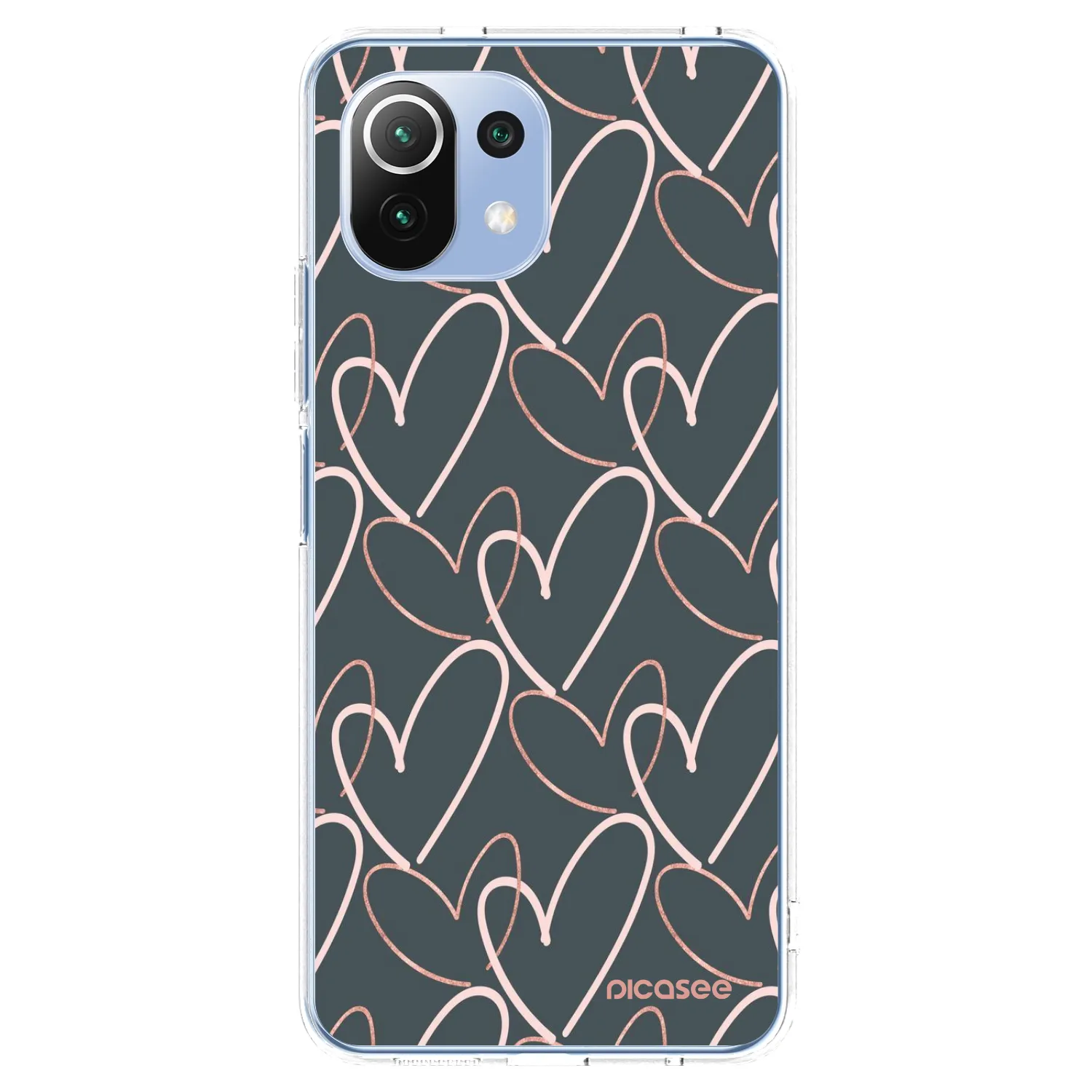 Picasee átlátszó szilikon tok az alábbi mobiltelefonokra Xiaomi Mi 11 Lite - Lots of love