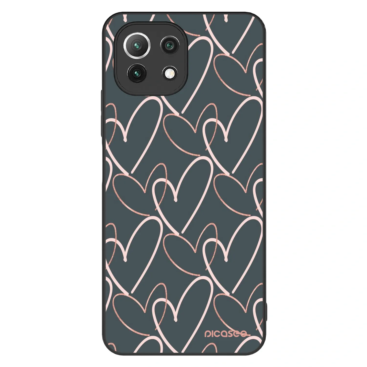 Picasee ULTIMATE CASE Xiaomi 11 Lite 5G NE - készülékre - Lots of love