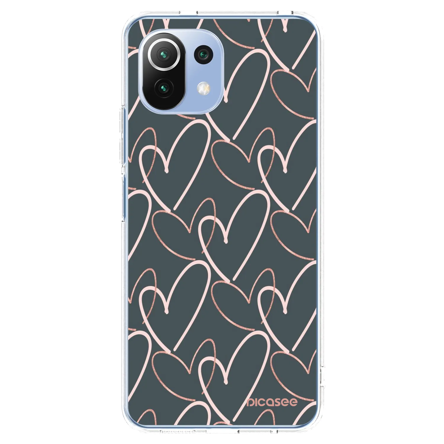 Picasee átlátszó szilikon tok az alábbi mobiltelefonokra Xiaomi 11 Lite 5G NE - Lots of love