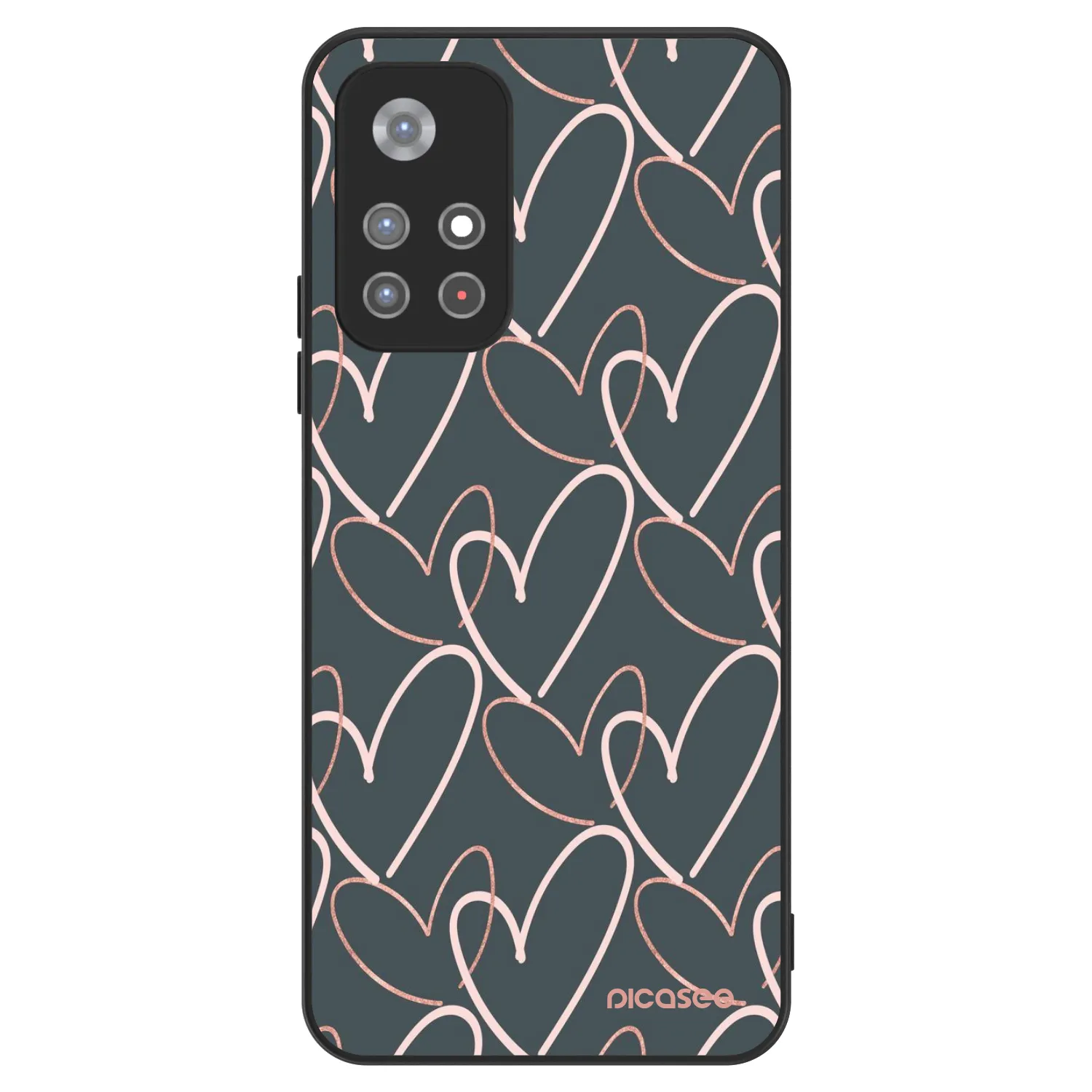 Picasee ULTIMATE CASE Xiaomi Redmi Note 11S 5G - készülékre - Lots of love
