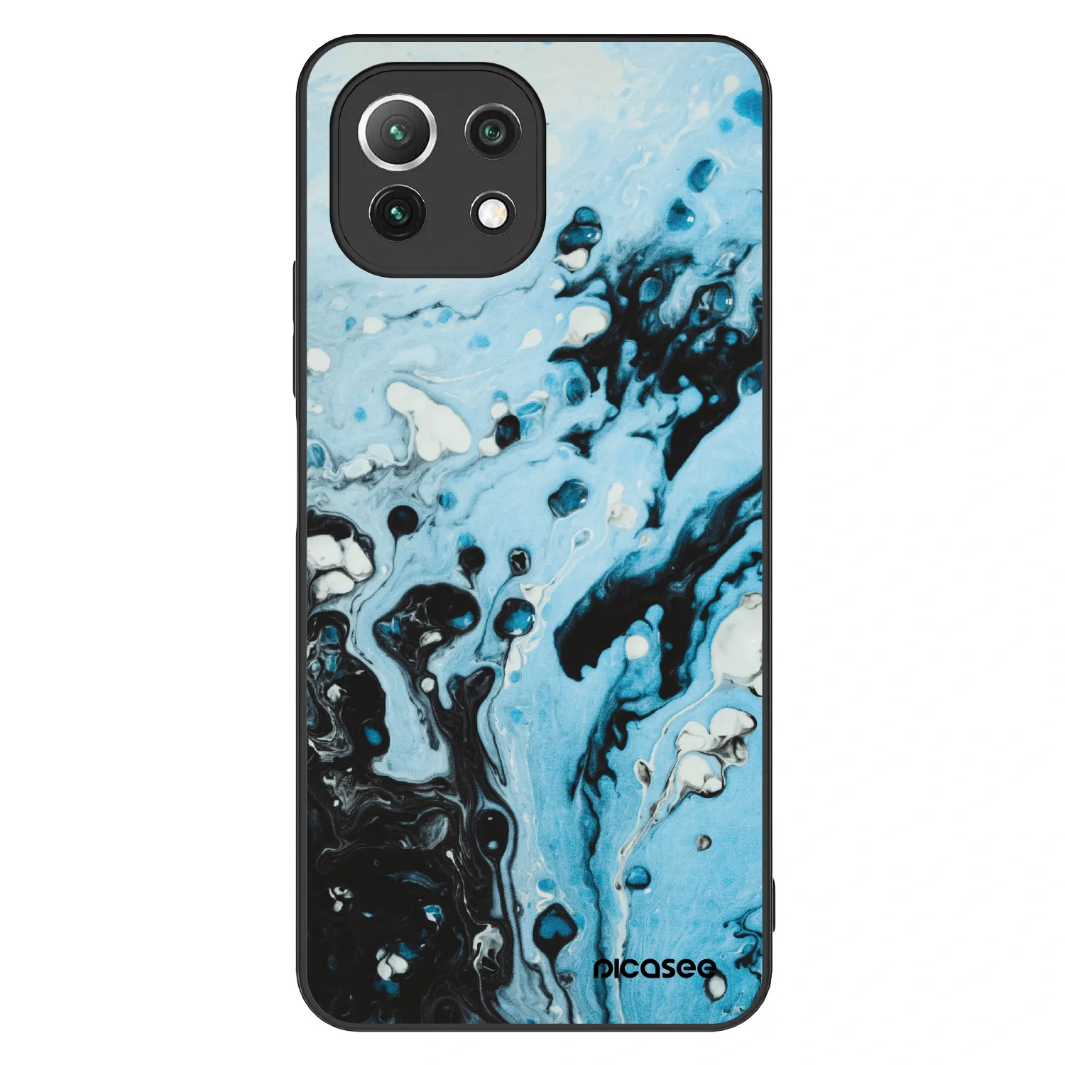 Picasee ULTIMATE CASE Xiaomi 11 Lite 5G NE - készülékre - Organic blue